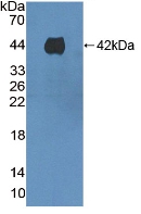 Polyclonal Antibody to Prothrombin Fragment 1+2 (F1+2)