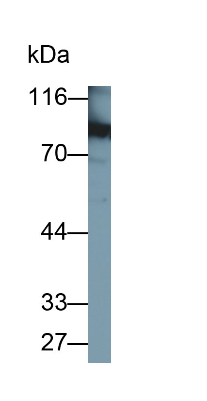 Polyclonal Antibody to Prothrombin Fragment 1+2 (F1+2)