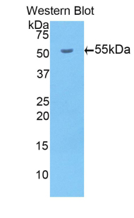 Polyclonal Antibody to Beta-Site APP Cleaving Enzyme 1 (bACE1)