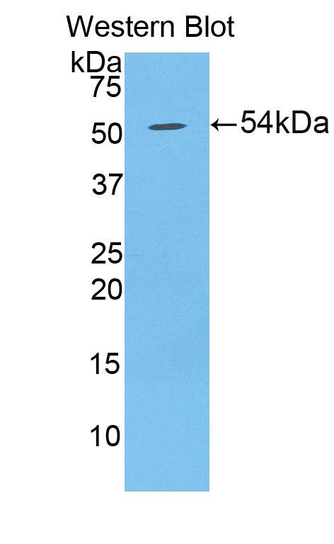 Polyclonal Antibody to Desmoglein 1 (DSG1)