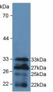 Polyclonal Antibody to Forkhead Box Protein O1 (FOXO1)