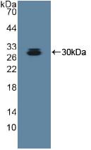 Polyclonal Antibody to A Disintegrin And Metalloprotease 10 (ADAM10)