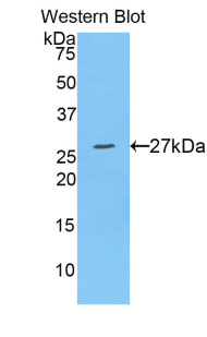 Polyclonal Antibody to A Disintegrin And Metalloprotease 10 (ADAM10)