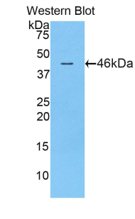 Polyclonal Antibody to Inducible T-Cell Co Stimulator (ICOS)