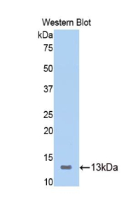 Polyclonal Antibody to Inducible T-Cell Co Stimulator (ICOS)