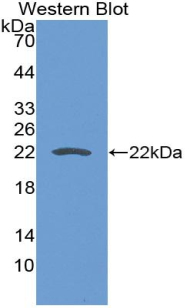Polyclonal Antibody to Cluster Of Differentiation 276 (CD276)