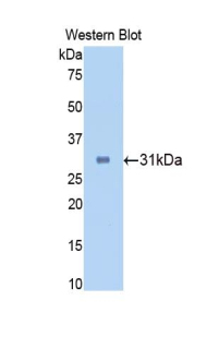 HRP-Linked Polyclonal Antibody to Carbonic Anhydrase II (CA2)