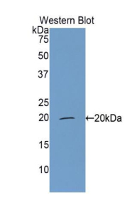 Polyclonal Antibody to Complement Factor P (CFP)
