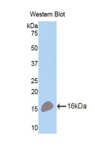 Polyclonal Antibody to Tumor Necrosis Factor Receptor Superfamily, Member 17 (TNFRSF17)