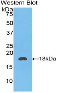 Polyclonal Antibody to Coagulation Factor IX (F9)
