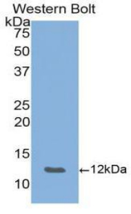Polyclonal Antibody to Epithelial Neutrophil Activating Peptide 78 (ENA78)