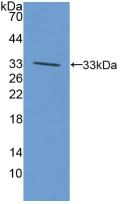 Polyclonal Antibody to Anaplastic Lymphoma Kinase (ALK)