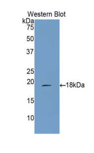 Polyclonal Antibody to Arachidonate-15-Lipoxygenase (ALOX15)