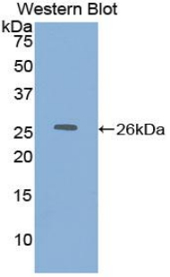 Polyclonal Antibody to Dihydrolipoyl Dehydrogenase (DLD)