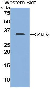 Biotin-Linked Polyclonal Antibody to Neutrophil Specific Antigen 1 (NB1)