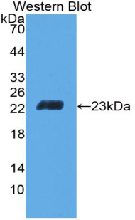 Polyclonal Antibody to Cluster Of Differentiation 6 (CD6)