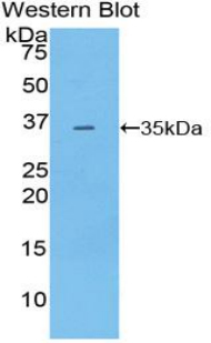 Polyclonal Antibody to Pyruvate Dehydrogenase Kinase 4 (PDK4)