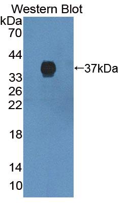 Polyclonal Antibody to ATP Binding Cassette Transporter G2 (ABCG2)