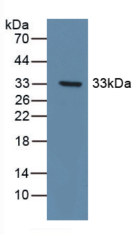 Polyclonal Antibody to Discoidin Domain Receptor Family, Member 1 (DDR1)