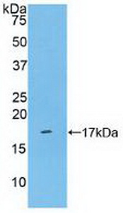 Polyclonal Antibody to Cluster Of Differentiation 161 (C<b>D161</b>)