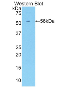 Polyclonal Antibody to Killer Cell Immunoglobulin Like Receptor 3DL2 (KIR3DL2)