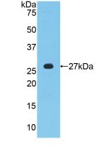 Polyclonal Antibody to Protein Zero, Myelin (MPZ)