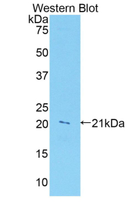 Polyclonal Antibody to Leukocyte Associated Immunoglobulin Like Receptor 1 (LAIR1)
