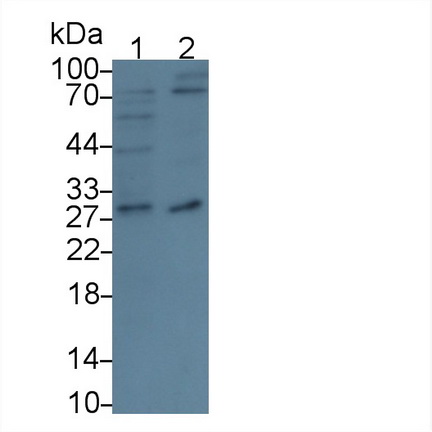Polyclonal Antibody to Cluster Of Differentiation 320 (CD320)