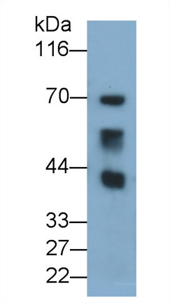 Polyclonal Antibody to Chemokine C-C-Motif Receptor 10 (CCR10)
