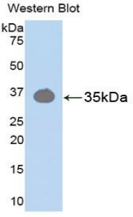 Polyclonal Antibody to Protein Kinase C Beta 1 (PKCb1)