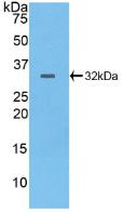 Polyclonal Antibody to Protein Tyrosine Phosphatase Receptor Type B (PTPRB)