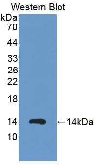 Polyclonal Antibody to S100 Calcium Binding Protein A12 (S100A12)