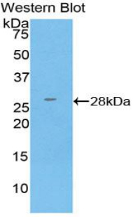Polyclonal Antibody to Glutathione S Transferase Kappa 1 (GSTk1)