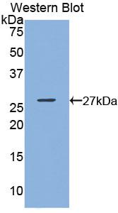 Polyclonal Antibody to Glutathione S Transferase Kappa 1 (GSTk1)