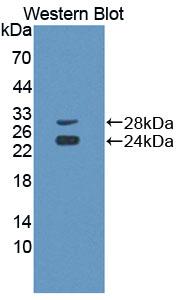 Polyclonal Antibody to Cluster Of Differentiation 8a (CD8a)