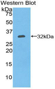 Polyclonal Antibody to Ectonucleoside Triphosphate Diphosphohydrolase 1 (ENTPD1)