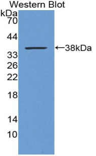 Polyclonal Antibody to Metallothionein 1 (MT1)