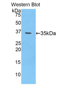 Polyclonal Antibody to Chondroitin Sulfate Proteoglycan 4 (CSPG4)