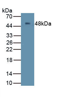 Polyclonal Antibody to Membrane Spanning 4 Domains Subfamily A, Member 1 (CD20)
