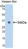 Polyclonal Antibody to Mitogen Activated Protein Kinase 14 (MAPK14)