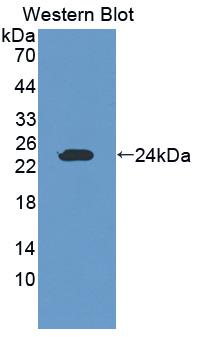 Polyclonal Antibody to Granzyme K (GZMK)
