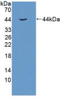 Polyclonal Antibody to Retinoblastoma Protein 1 (RB1)