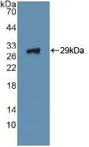 Polyclonal Antibody to Integrin Alpha 2 (ITGa2)