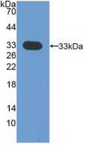 Polyclonal Antibody to Cyclin Dependent Kinase 4 (CDK4)