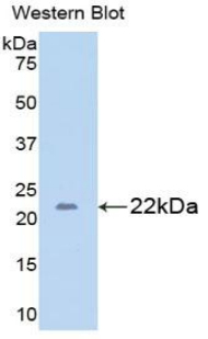 Polyclonal Antibody to Glutamate Decarboxylase 2 (GAD2)