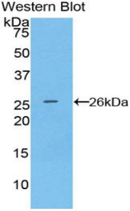 Polyclonal Antibody to Cluster Of Differentiation 72 (CD72)