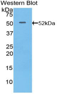 Polyclonal Antibody to Integrin Alpha 6 (ITGa6)