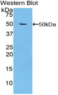 Polyclonal Antibody to Integrin Alpha 5 (ITGa5)