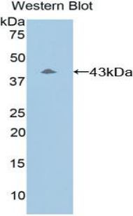 Polyclonal Antibody to Complement Component 8b (C8b)