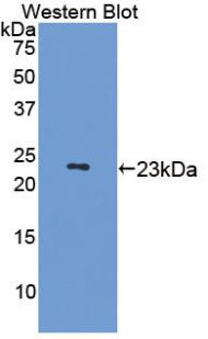 Polyclonal Antibody to Microtubule Associated Protein 4 (MAP4)